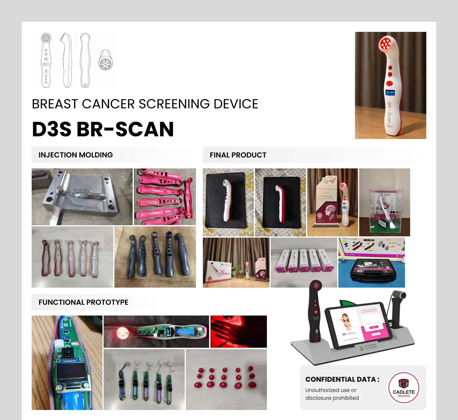 BR-Scan: AI-Powered Breast Screening Device, From Patent to Certified Mass Production